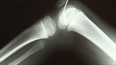 A kép csak illusztráció, forrás: bbc.co.uk